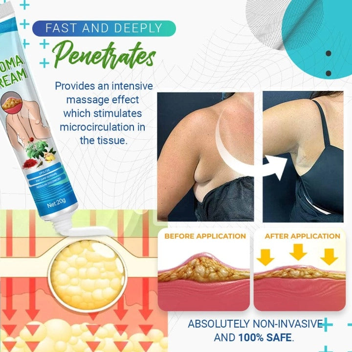 Crema para eliminar lipomas LumpFree