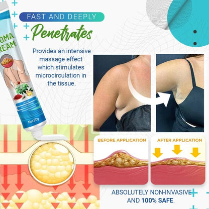 Crema para eliminar lipomas LumpFree