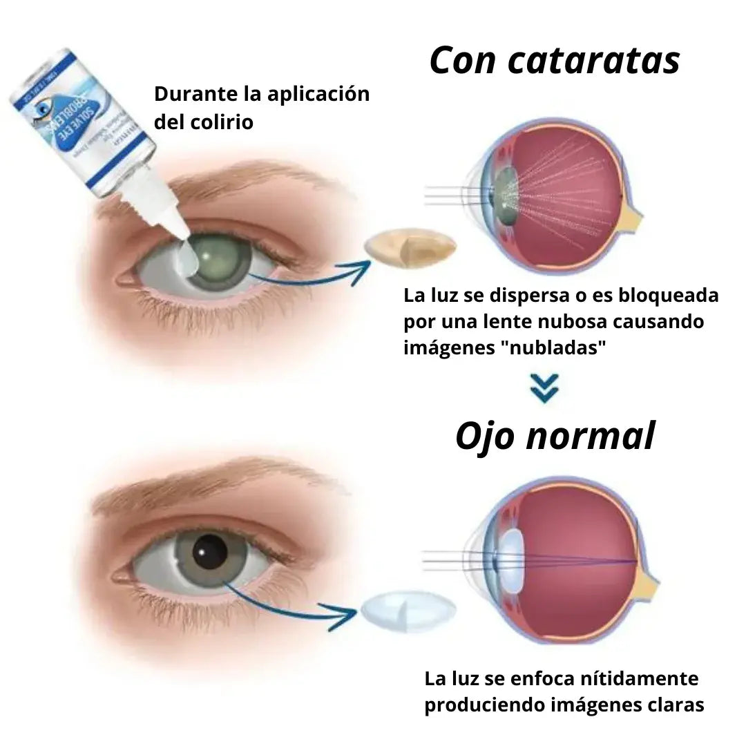 GOTAS OFTÁLMICAS MILAGROSAS PARA PROBLEMAS DE OJOS