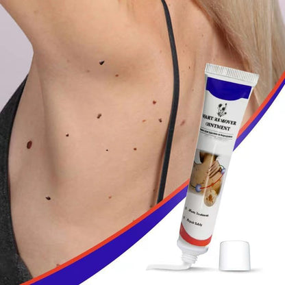 Ungüento para eliminar verrugas 20 g