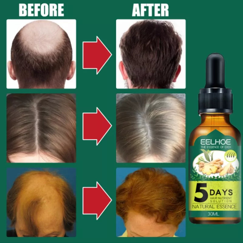 SUERO PARA EL CRECIMIENTO DEL CABELLO