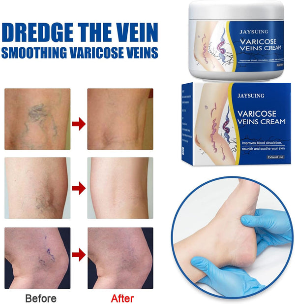 Crema Mágica para Venas