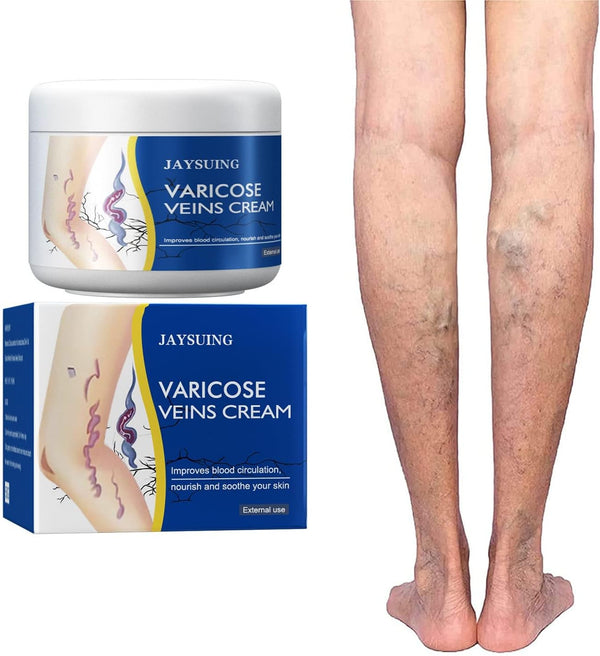 Crema Mágica para Venas