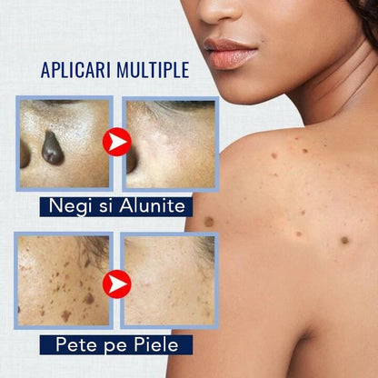 CREMA CONTRA VERRUGAS Y MANCHAS PIGMENTADAS